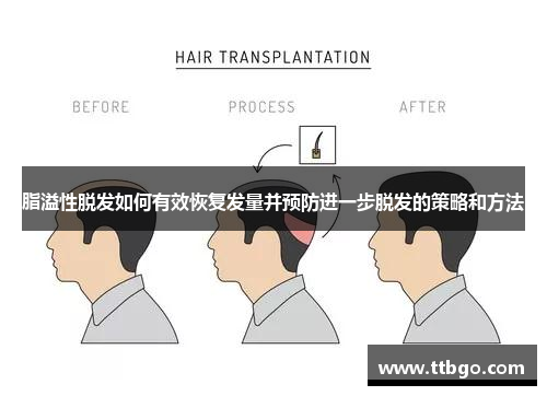 脂溢性脱发如何有效恢复发量并预防进一步脱发的策略和方法